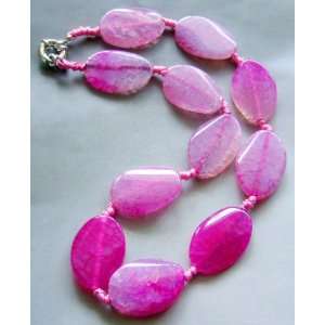  Pink Dragon Skin Agate Gem Beads Necklace: Everything Else
